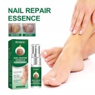 Nail Treatment & Strengthener Renews Nails Protective for Toenail & Nail | Manicure/Pedicure Tools & Kits | Long Term Use