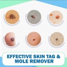 Tags and Moles Remover Device Natural Effective Scar-Free for Face Skin Care