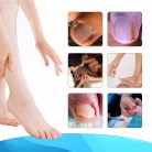 Ingrown Toe Nail Repair Foot Corrector Stickers Paronychia Treatment 50pcs